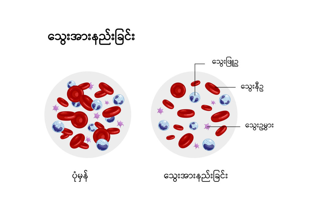 Anaemia img1