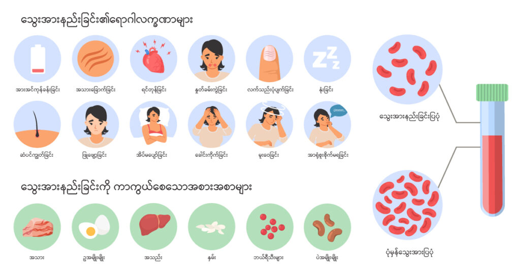 Anaemia img2