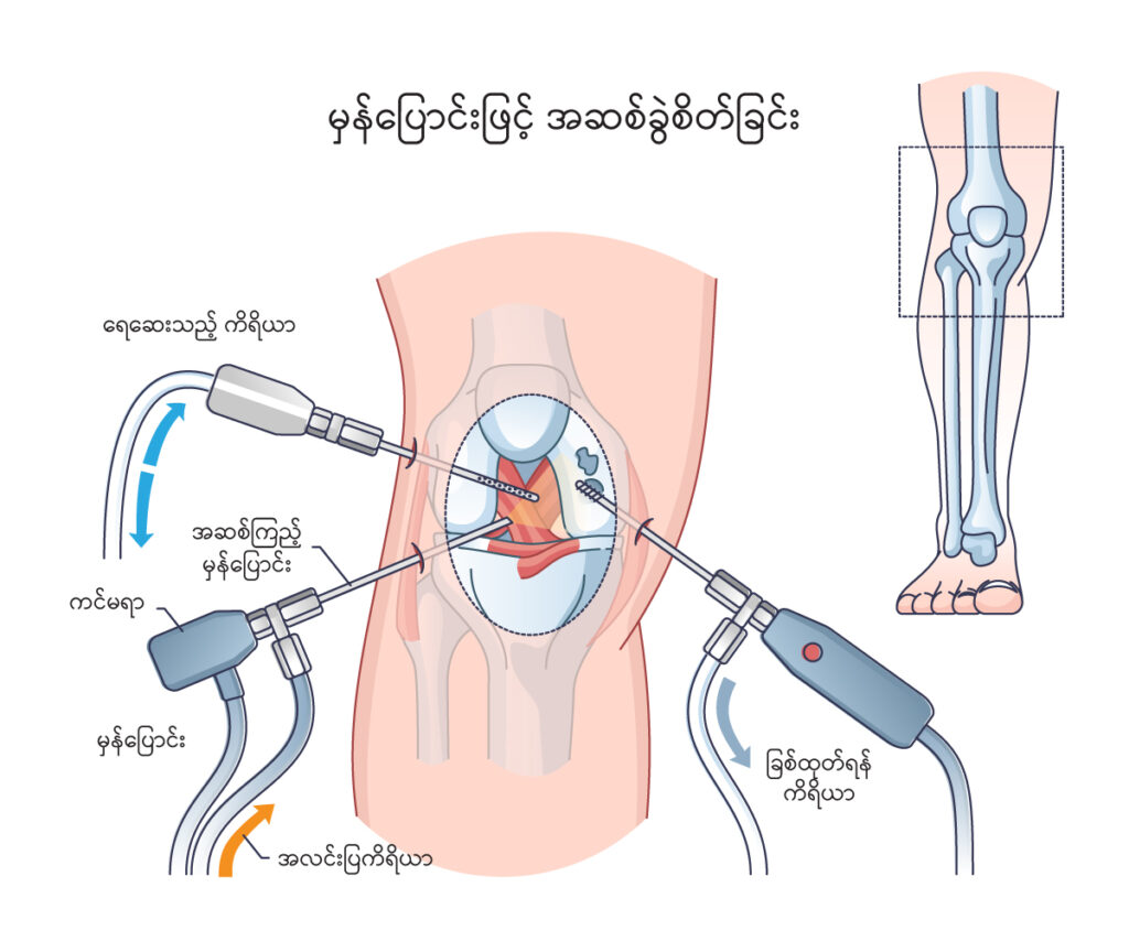 Arthroscopy IMG1