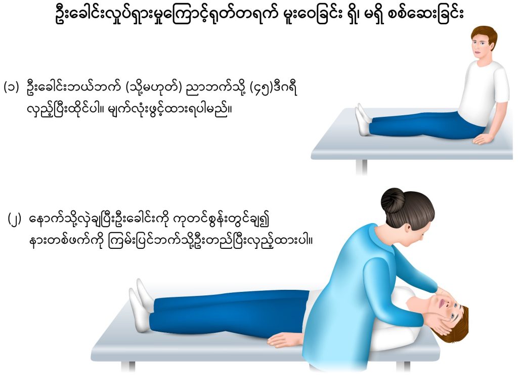 BPPV image2