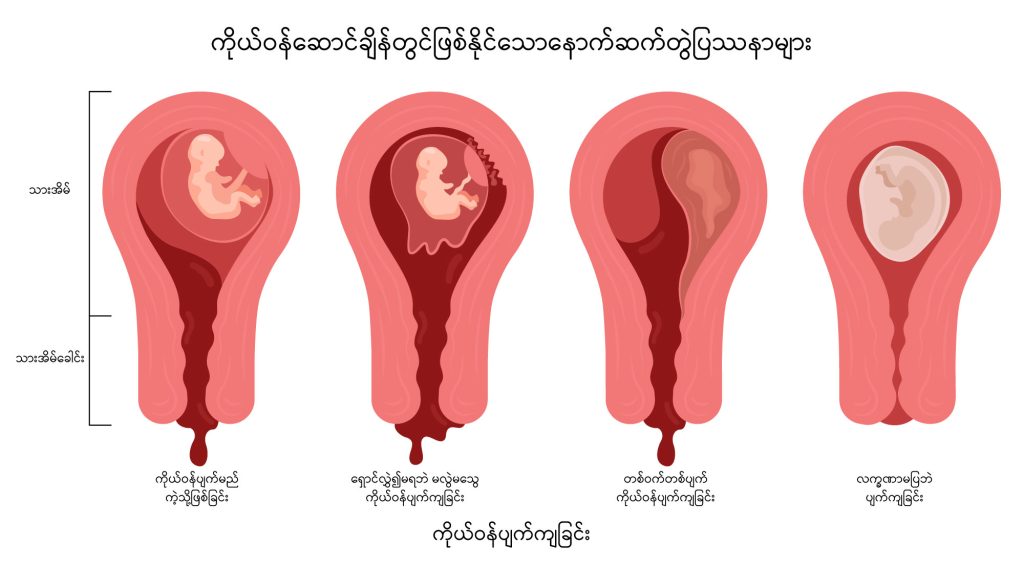 Miscarriage image1