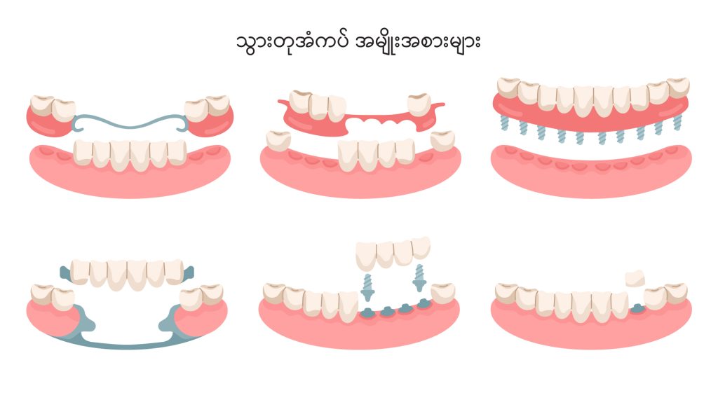 Dentures IMG1