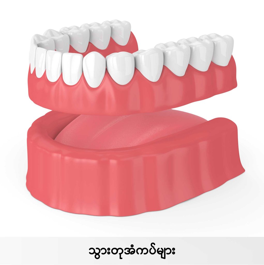Dentures IMG2