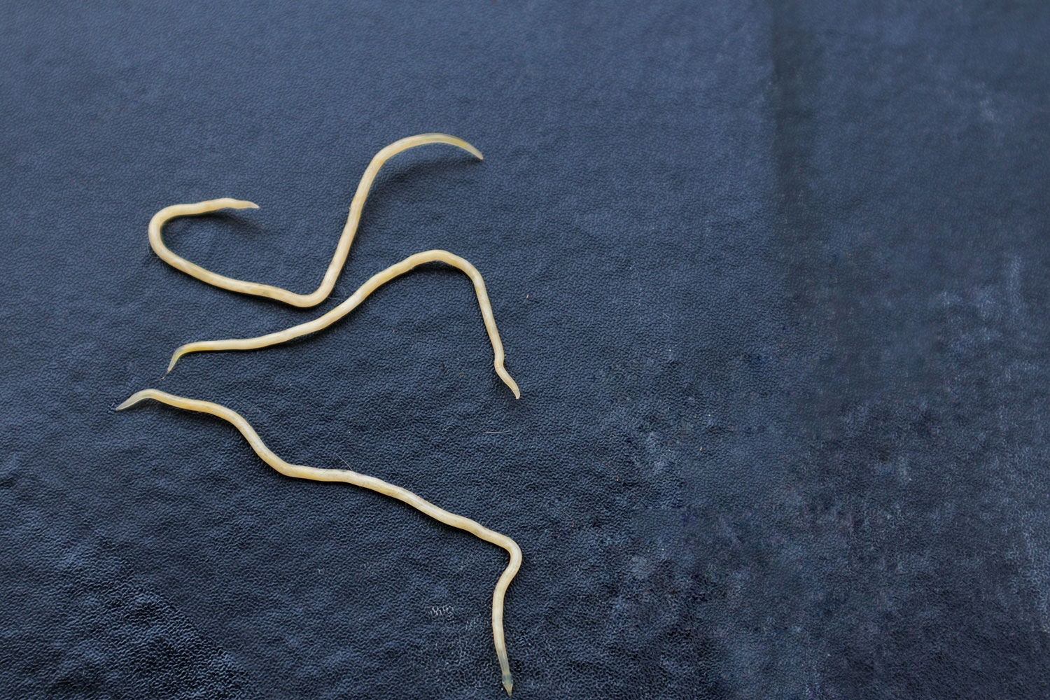 Worm Infested Cc Worm Infestation (သန်ကောင်တွယ်ခြင်း/သန်ကောင်ဝင်ရောက်ကူးစက်ခြင်း) - CLL ...