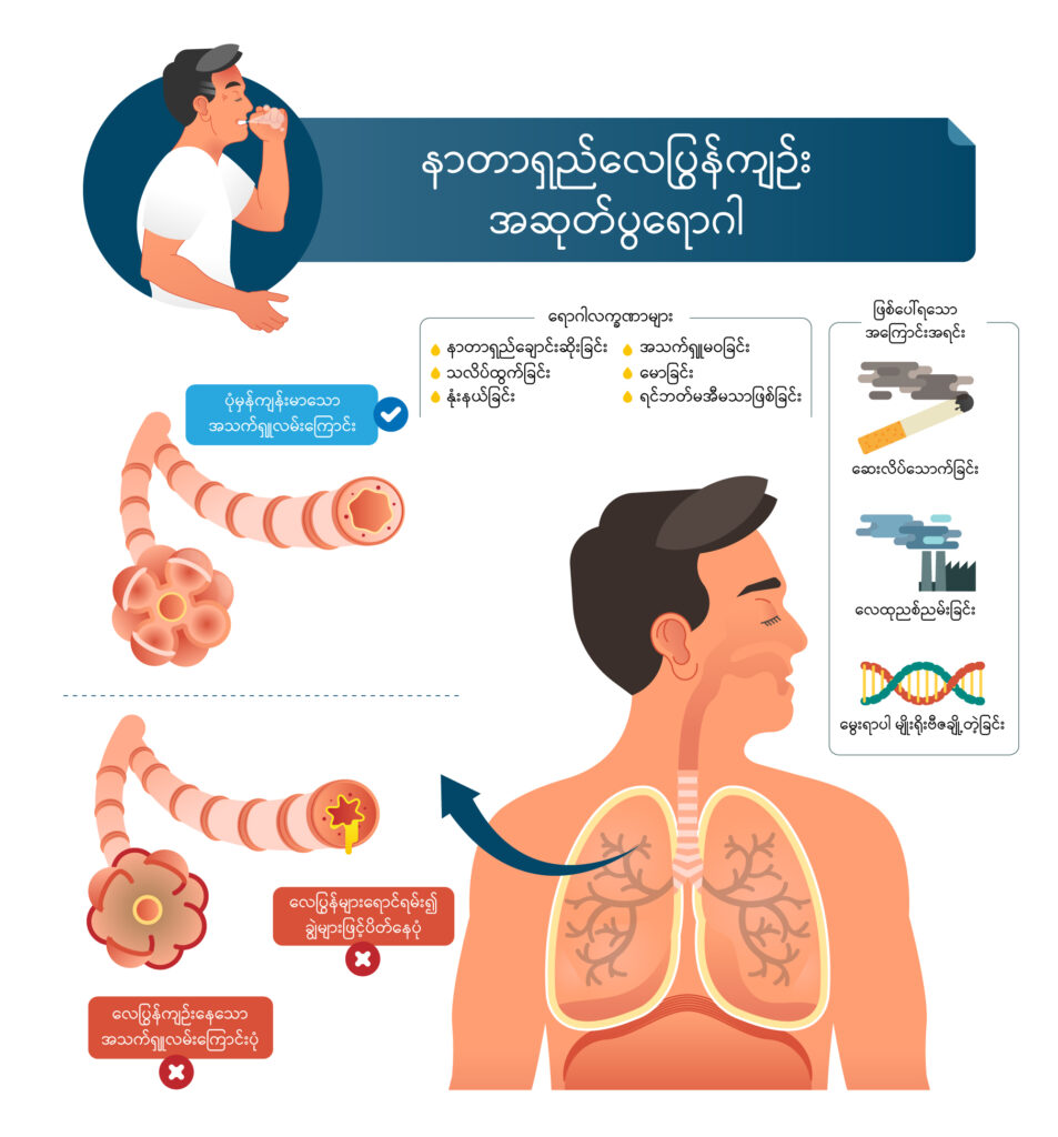 COPD image 2
