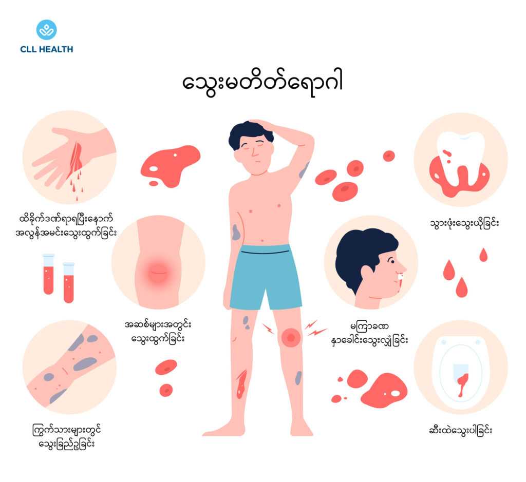 Hemophilia image 1