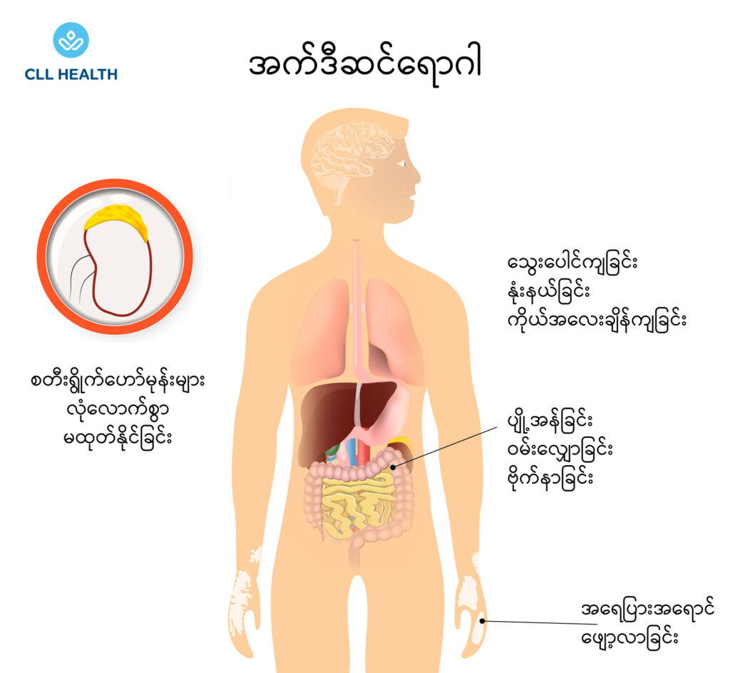 Addison's disease image 1