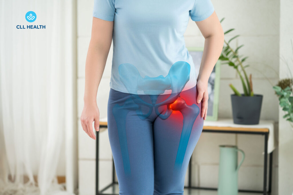 Hip pain image 1