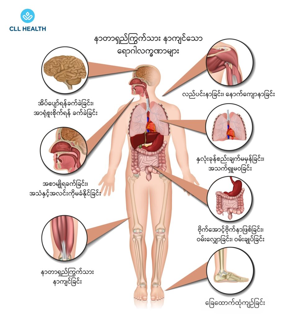 fibromyalgia image 1